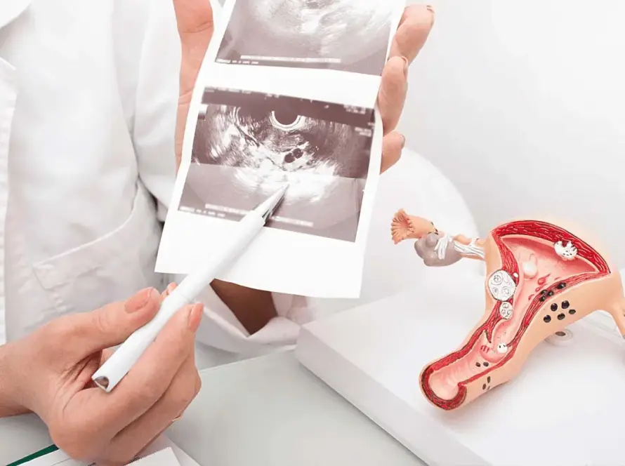 Λαπαροσκόπηση