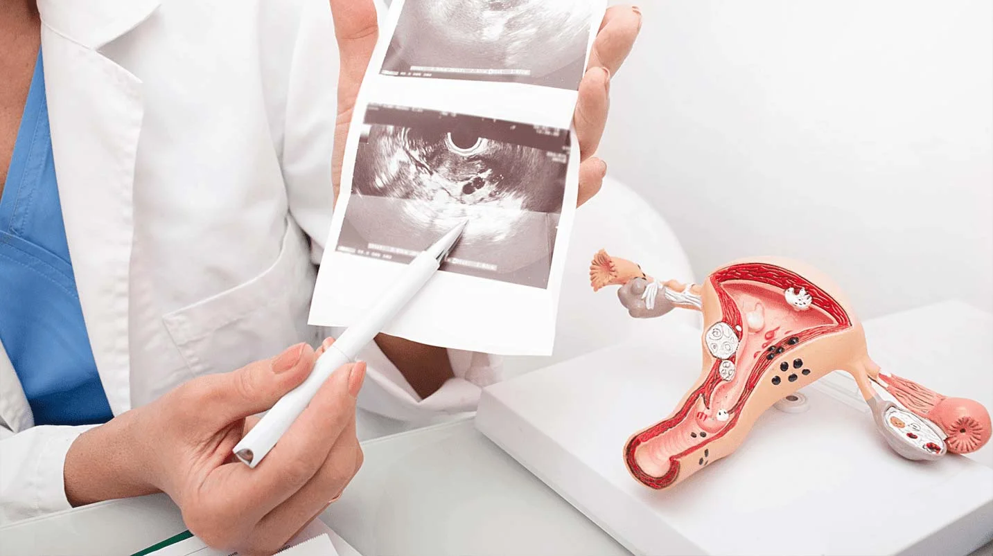 Λαπαροσκόπηση