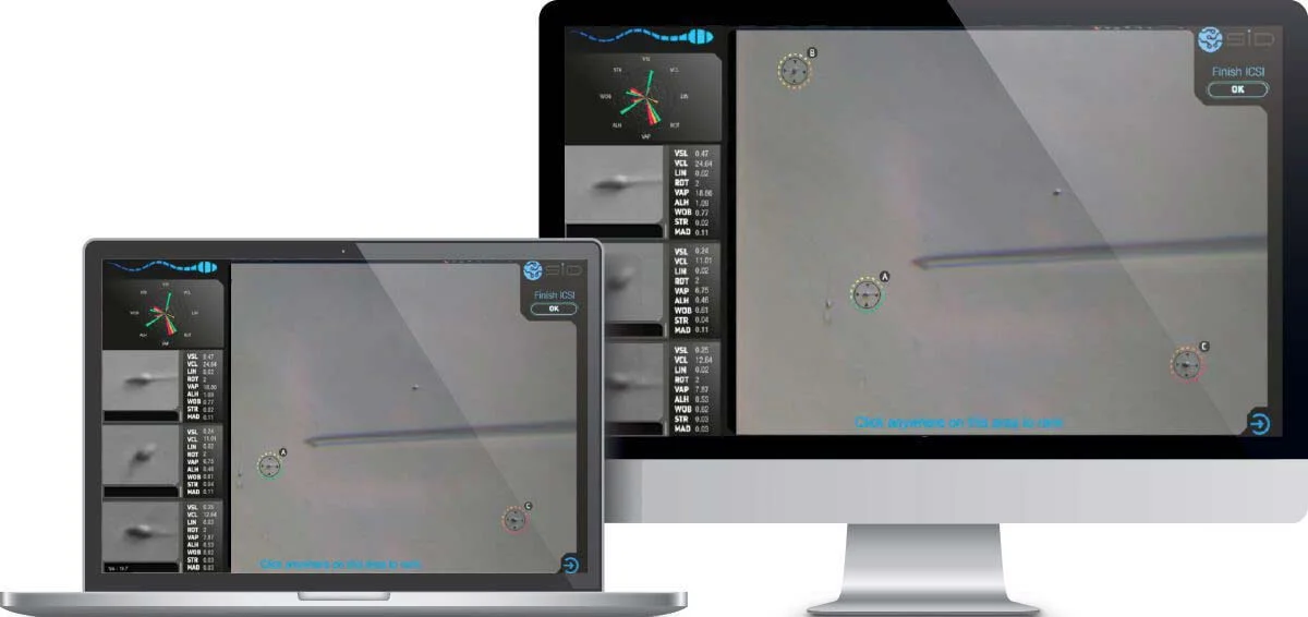 Τεχνητή νοημοσύνη AI στην Υποβοηθούμενης Αναπαραγωγής (IVF)