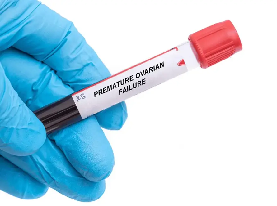 Πρόωρη ωοθηκική ανεπάρκεια