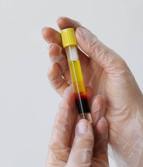 hands-holding-vial-prp-treatments-close-up (1)