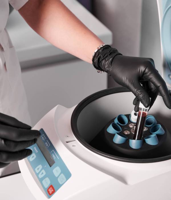 Close up of scientist hands in black sterile gloves placing test tube with blood sample in centrifuge machine. Female technician preparing material for plasmolifting. Concept of clinical medicine.